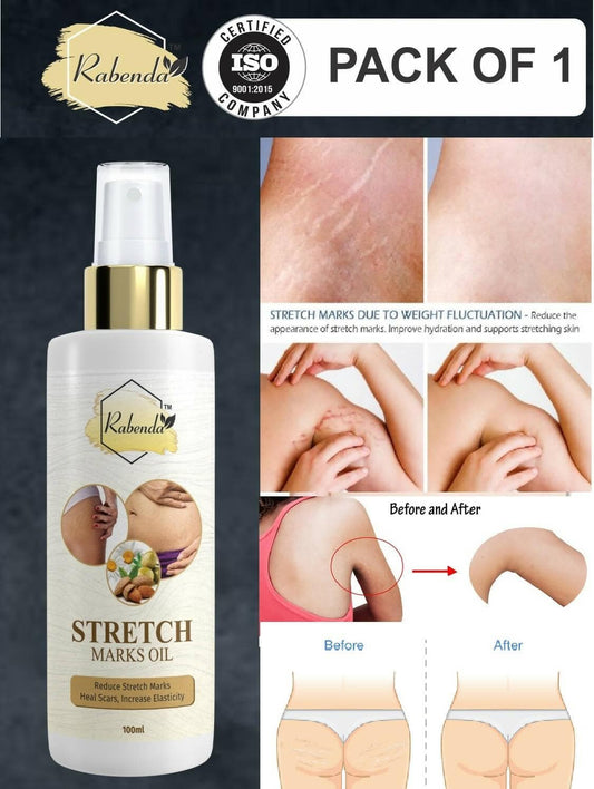 Rabenda Repair Stretch Marks Removal (100 GM) - HalfPe